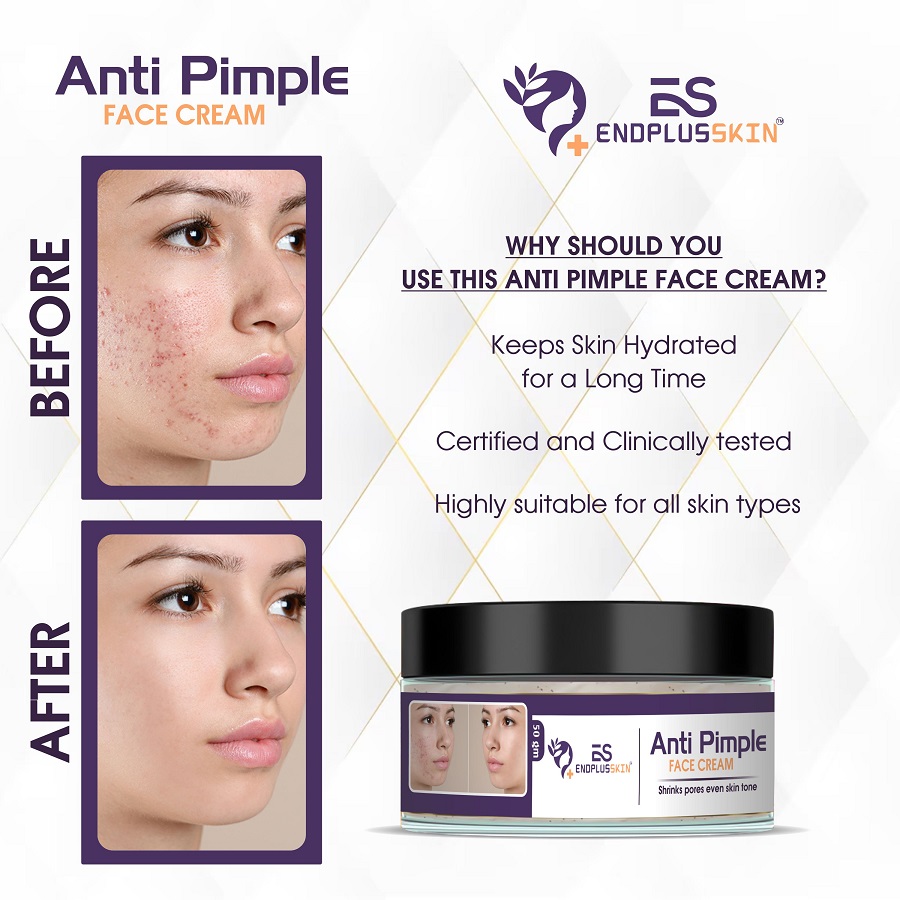 Anti Pimple Face Cream