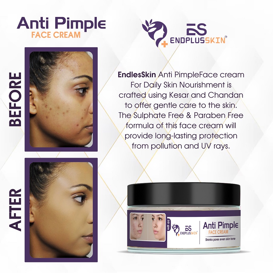 Anti Pimple Face Cream