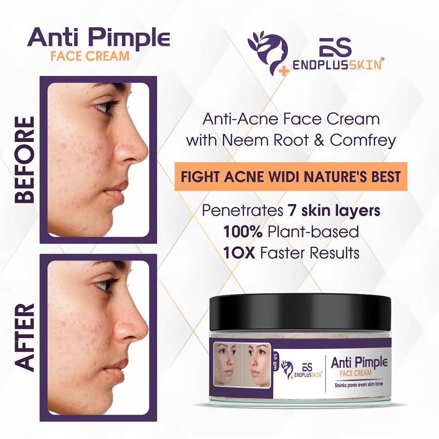 Anti Pimple Face Cream